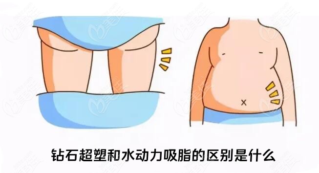 钻石超塑和水动力吸脂的区别是什么