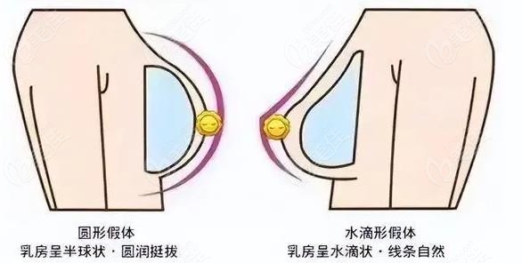 水滴形和圆形胸对比照