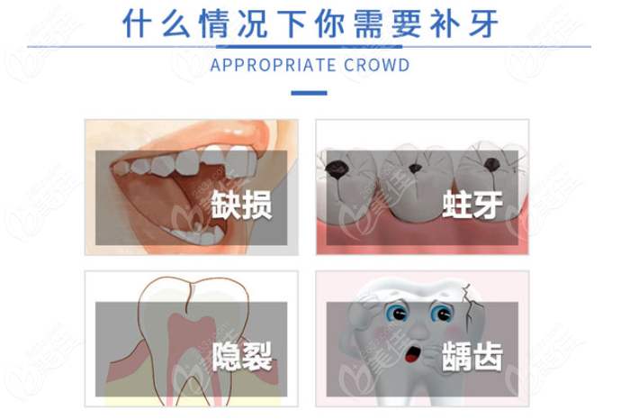 赣州补牙哪家便宜又好