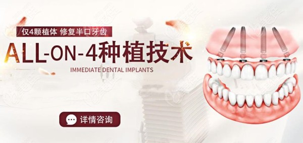 <!--<i data=20240703-sp></i>-->口腔医院种植牙