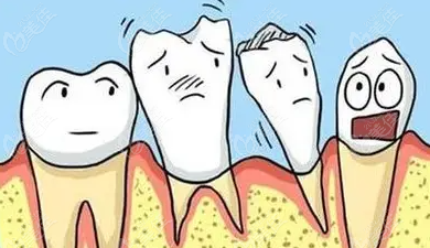 牙髓炎拖几个月会恶化吗