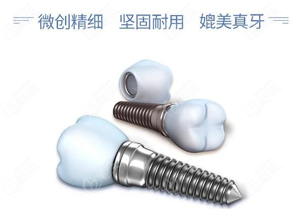 北京昌平区韩国种植牙价格236z.com
