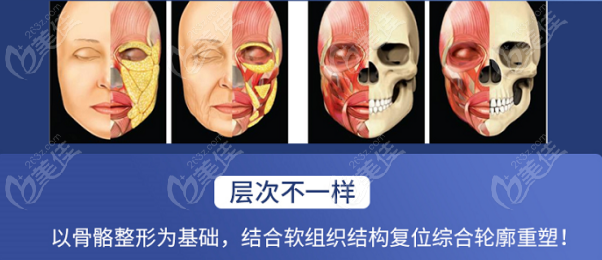 刘正茂做下颌角的同时会全面重塑脸型