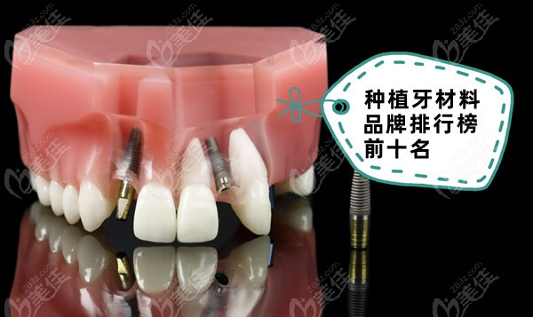 种植牙材料品牌排行榜前十名