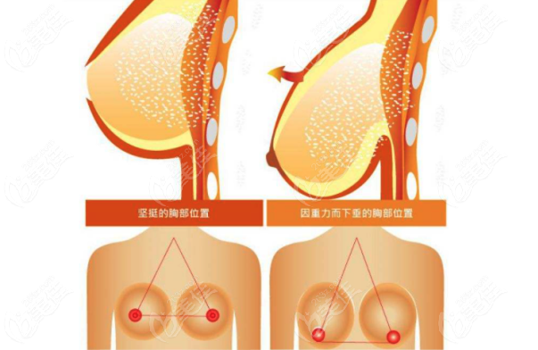 上海乳房下垂矫正医院排名前十
