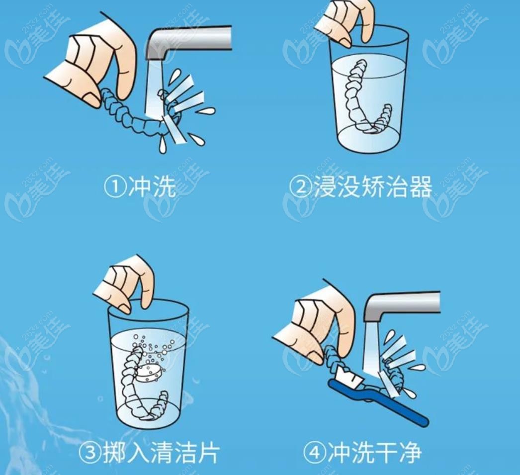 清洗隐形牙套步骤