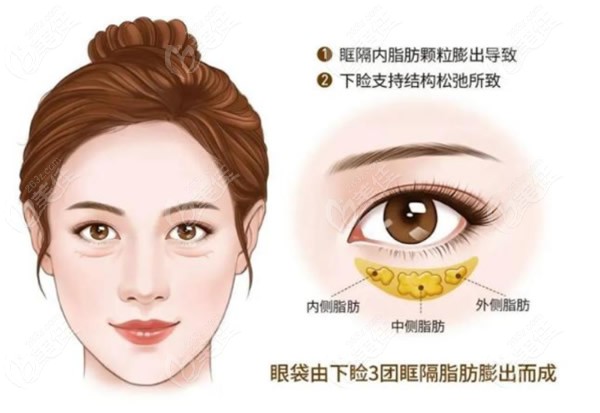 <!--<i data=20240703-sp></i>-->做眼袋修复有名的医生有哪些