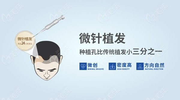 南昌哪里可以植发(南昌哪里可以植发的医院)