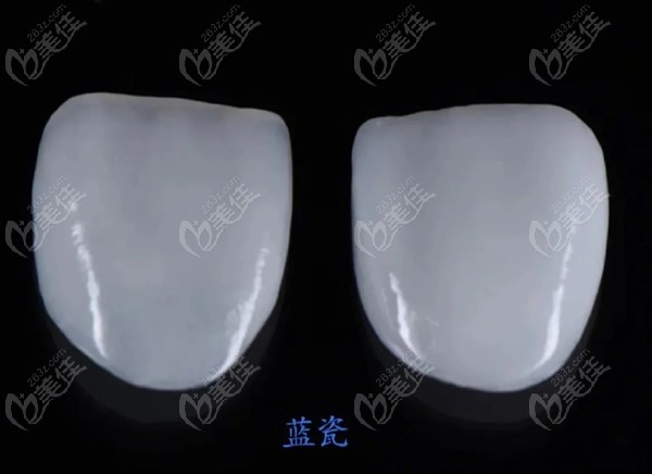 蓝瓷牙贴面是什么材料？236z.com