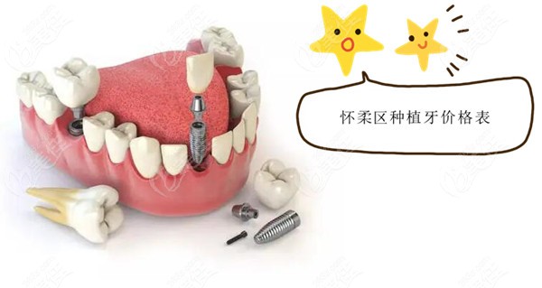 北京怀柔区种植牙价格表236z.com