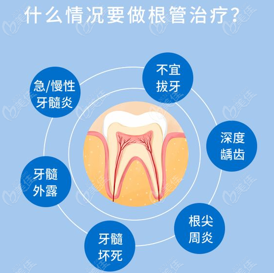 大同哪里做根管治疗不疼