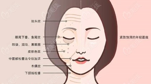 2025北京拉皮手术性价比高的医生
