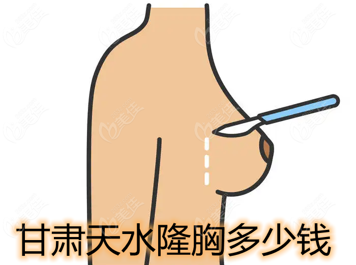 甘肃天水隆胸多少钱
