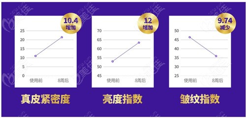 pdo胶原蛋白填充的变化
