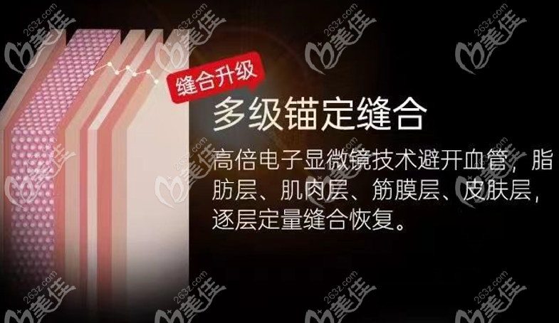 武汉艺星美杜莎MDC中面部提升拉皮手术优势