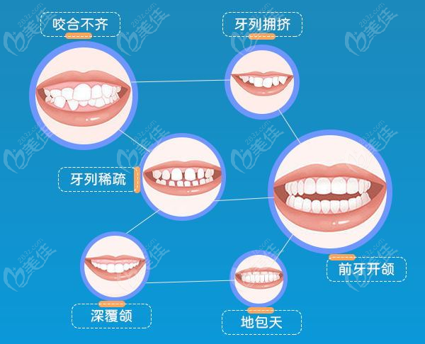 泸州尚好口腔牙齿矫正价格表236z.com