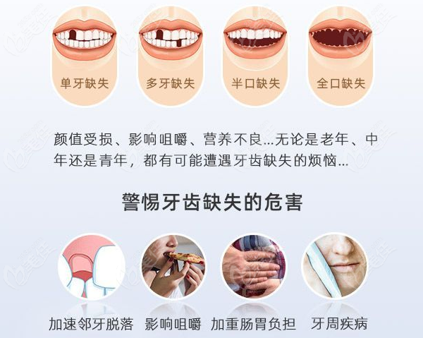 泸州尚好口腔种植牙收费价格表