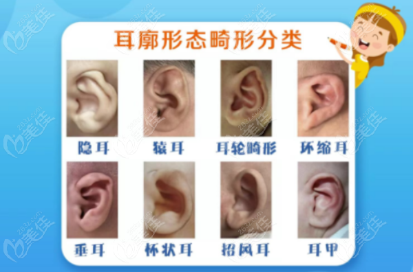 四川小耳畸形矯正醫(yī)院排名