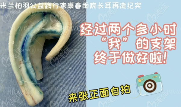 成都米蘭柏羽整形康春雨醫(yī)生耳再造怎么樣