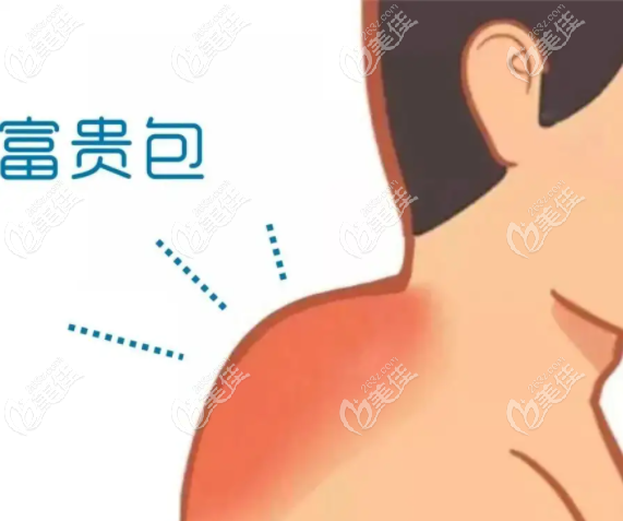 一针去富贵包236z.com