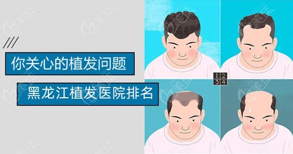 黑龙江植发医院排名