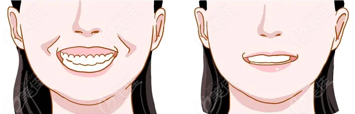 正畸正颌手术