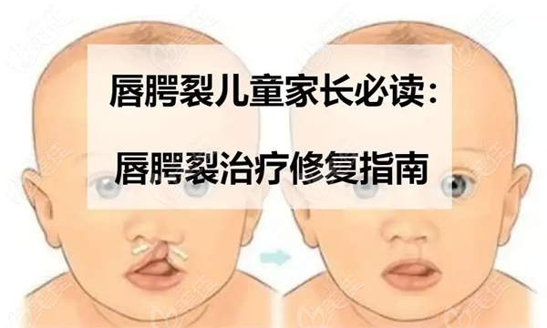 上海薇琳医院王国民医生唇腭裂修复技术和费用怎么样？