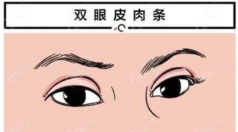 桂林双眼皮修复好的医生排名