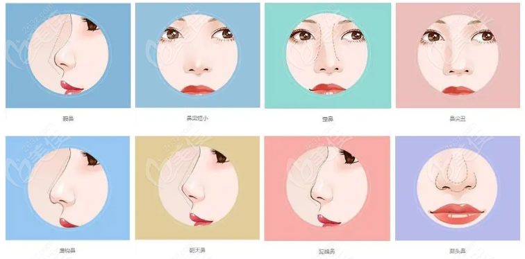 www.236z.com哈尔滨艺星隆鼻价格表