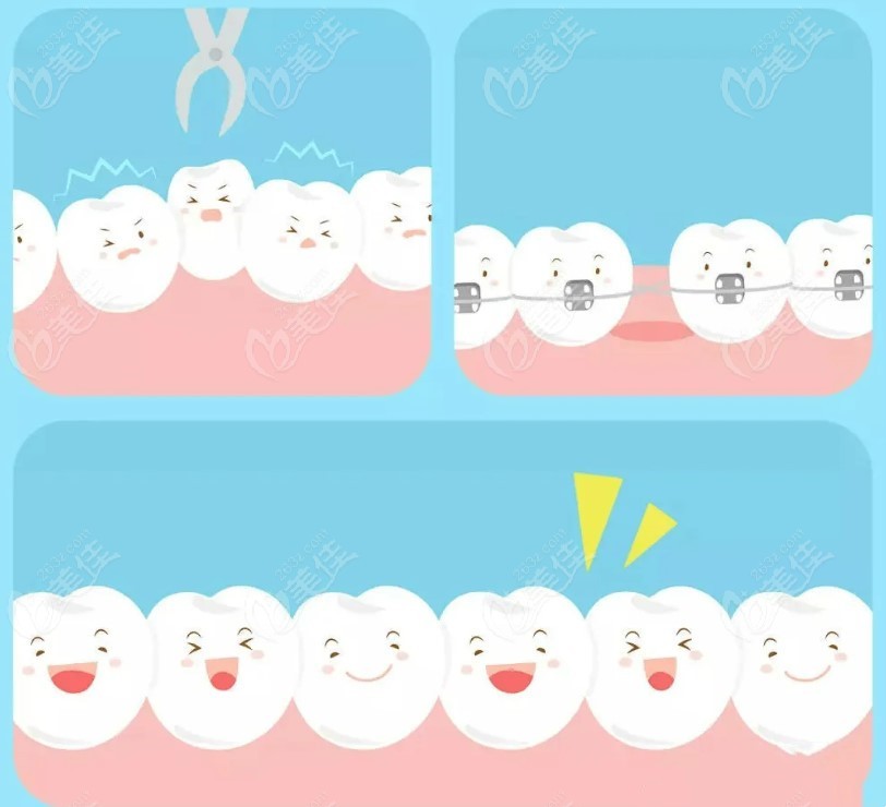 蒙自博爱口腔矫正牙齿多少钱
