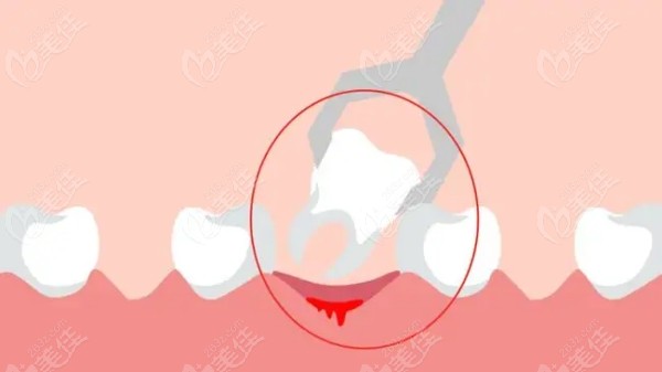 沈阳和平区拔牙去哪里236z.com
