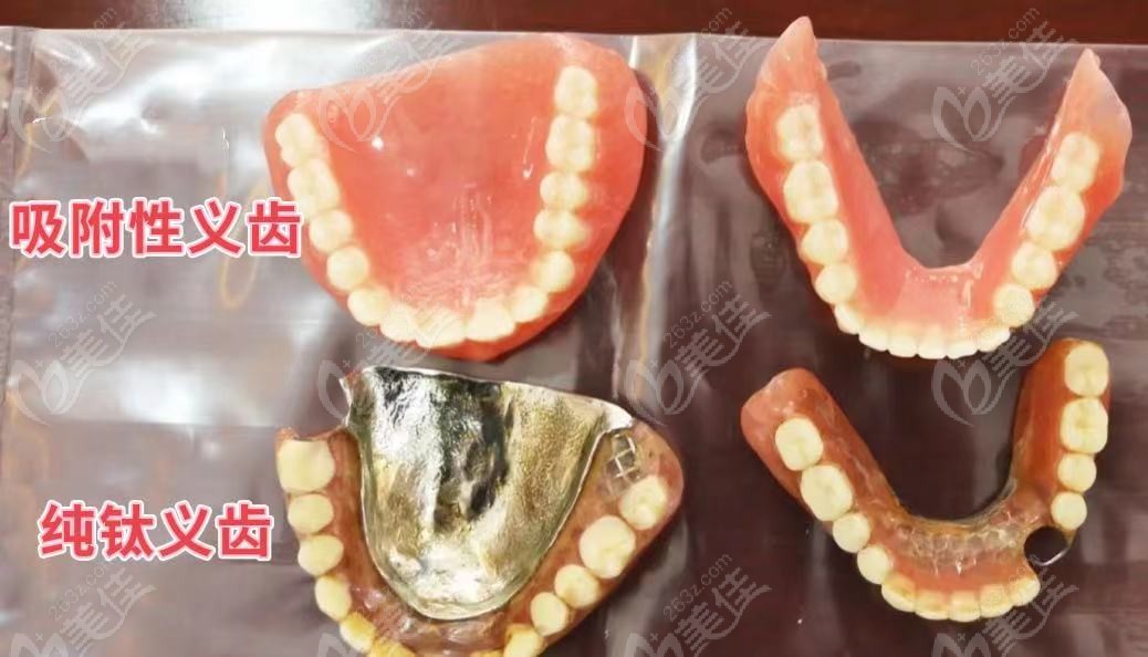 纯钛义齿和吸附性义齿区别