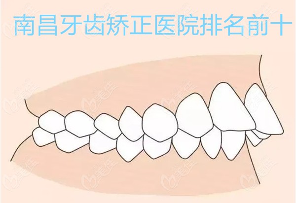 南昌牙齿矫正医院排名前十