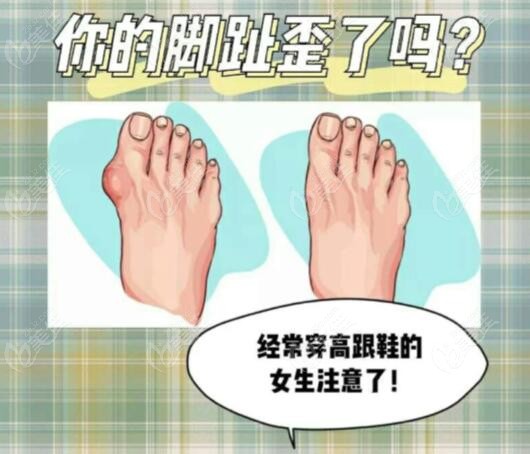 苏敬达大脚骨手术特色m.236z.com分享