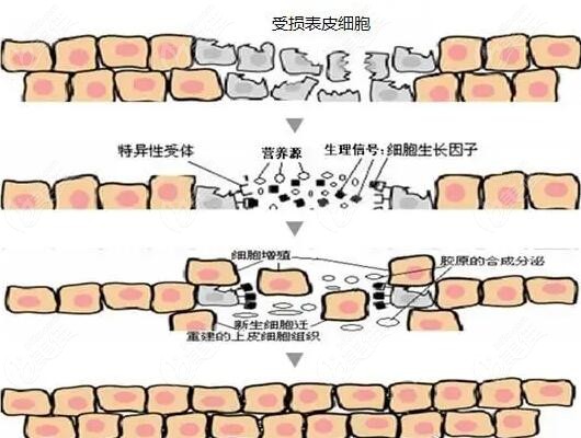 生长因子注射后怎么解决m.236z.com