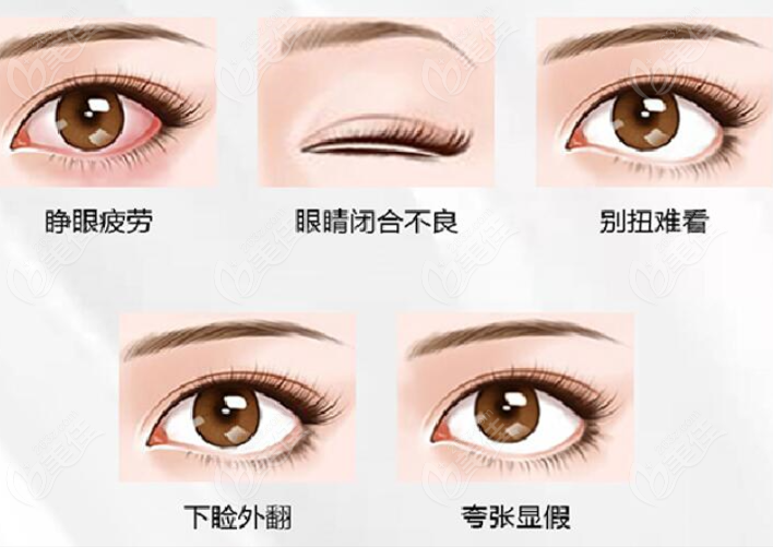 國(guó)內(nèi)可以修復(fù)的眼瞼下至的類(lèi)型 國(guó)內(nèi)可以修復(fù)的眼瞼下至的類(lèi)型
