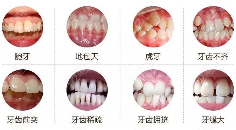 北京隐形牙齿矫正一般多少钱236z.com