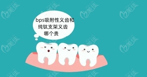 bps吸附性义齿和纯钛支架义齿哪个贵
