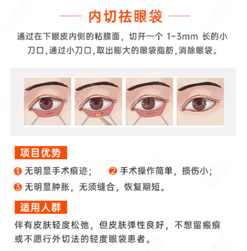 南京美贝尔整形，是南京内外路去眼袋厉害的医院