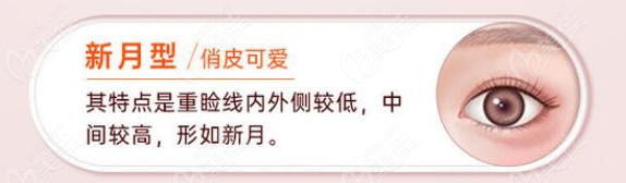 朱姗姗，是南京比较好的割双眼皮医生m.236z.com