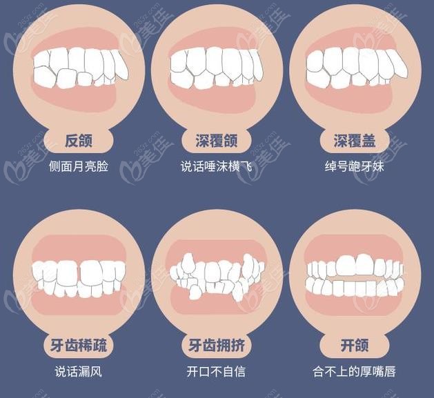 儿童早期干预适应症