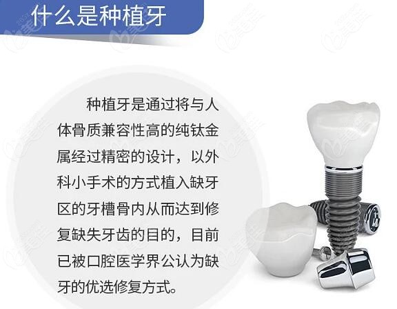 北京延庆区一颗种植牙价格236z.com