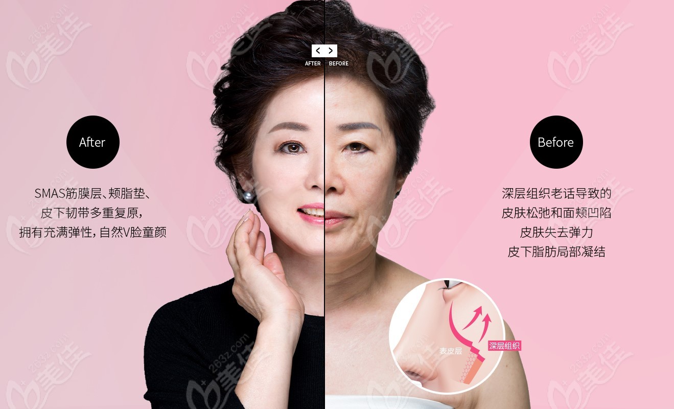 韩国明星皮肤管理