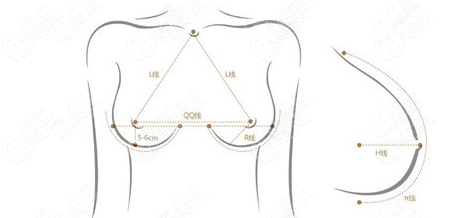 五维多层定制脂肪丰胸术手术操作融合一定的美学设计（www.236z.com）
