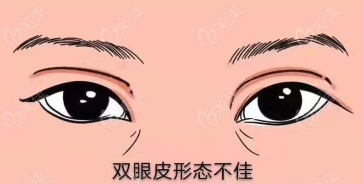 上海眼部修复多少钱