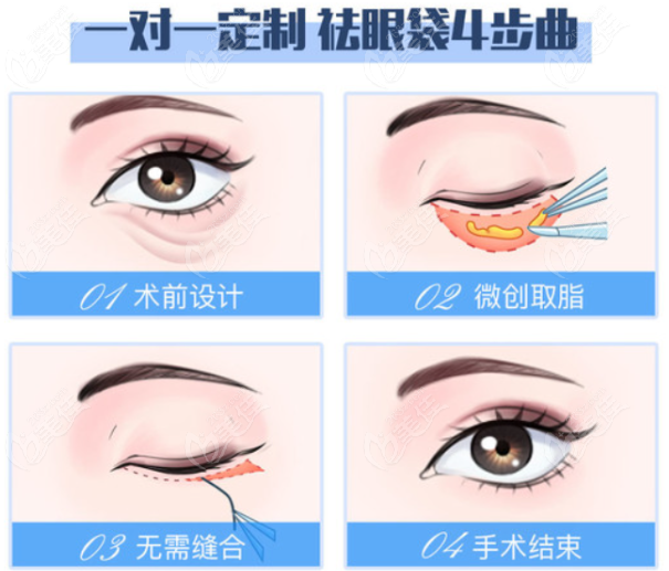 成都锦江祛眼袋医院哪家好