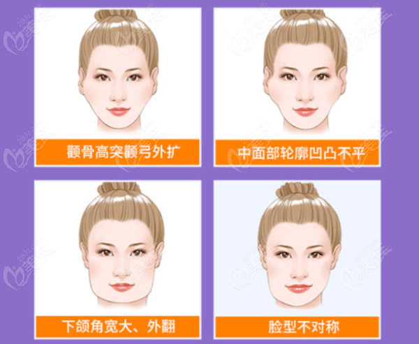 成都改脸型好的医院排名