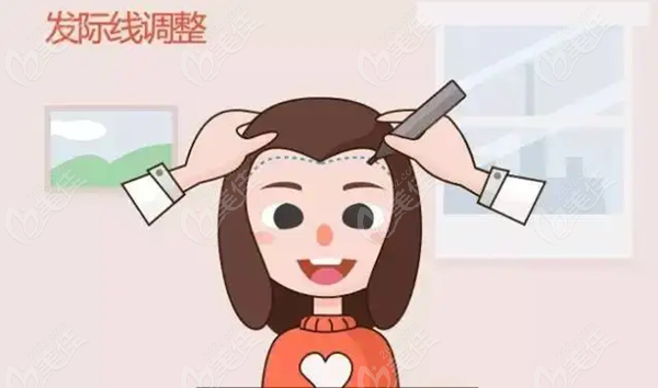发际线高做额头缩小术多少钱