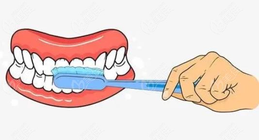 清洁牙齿