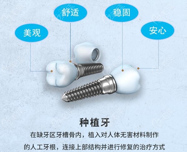 北京斯迈尔口腔常规种植牙收费标准